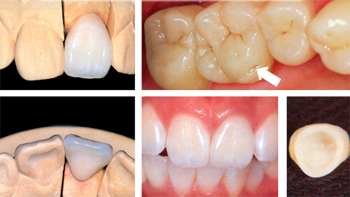 �I�[���Z���~�b�N