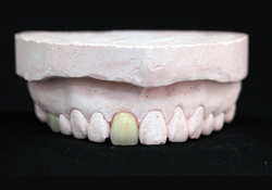 �I�[���Z���~�b�N