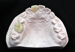 �I�[���Z���~�b�N