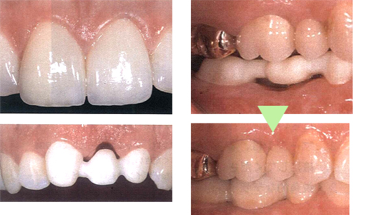 �W���R�j�A�I�[���Z���~�b�N