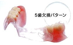 �i�`�������f���`���[�v���X