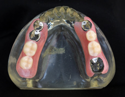 �m���N���X�v�`��