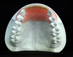 �m���N���X�v�`��