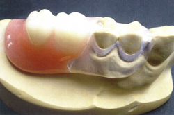 �m���N���X�v�`��