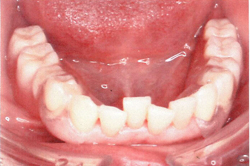 �m���N���X�v�`��