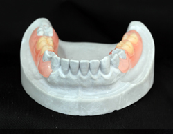 �m���N���X�v�`��