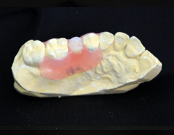 �m���N���X�v�`��